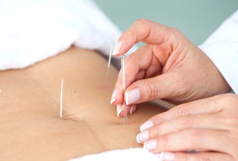 Læge-påføring-akupunktur-på-maven